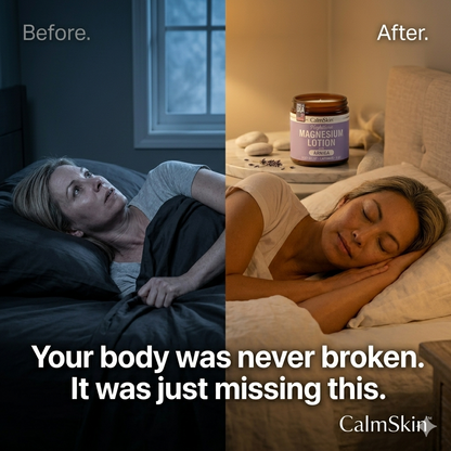 CalmSkin™ Magnesium Cream Lotion